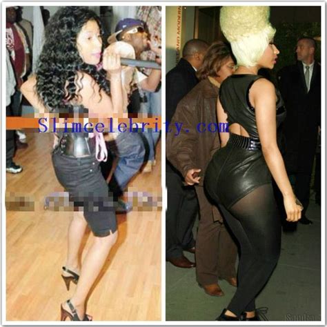 nicki minaj booty implants|This Throwback Video Of A Pre.